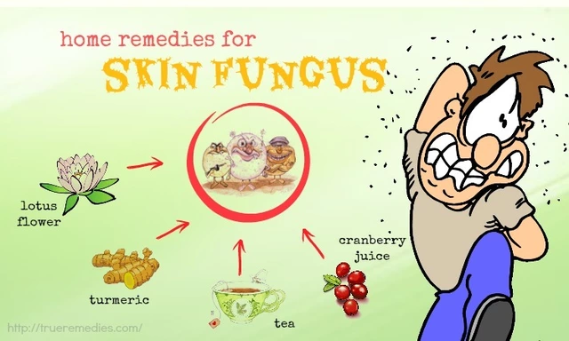 How to treat skin irritations caused by fungal infections.
